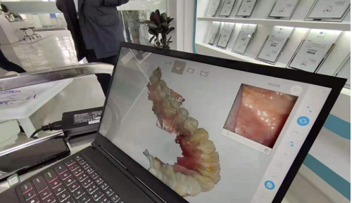 3D打印技术在牙科义齿领域中牙套制作的应用是怎样的呢?(图2) 3D打印技术在牙科义齿领域中牙套制作的应用是怎样的呢?(图2)